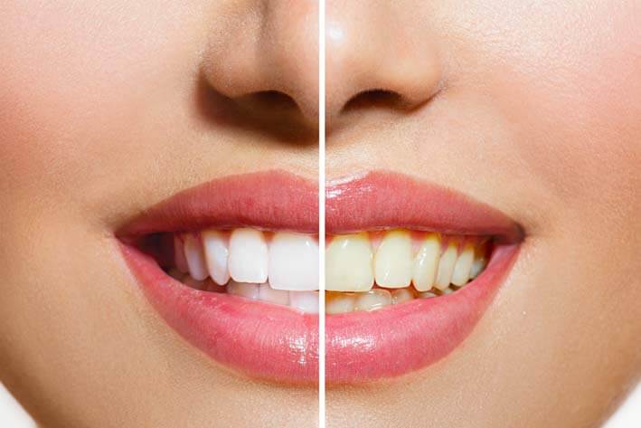 cosmetic dentistry suffolk